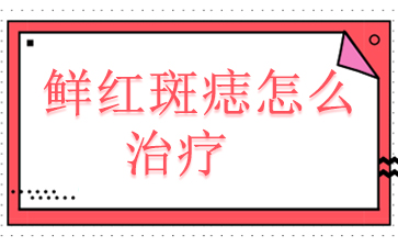 ʺƷ-ʺô