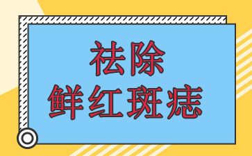 ʺƷ-ʺ